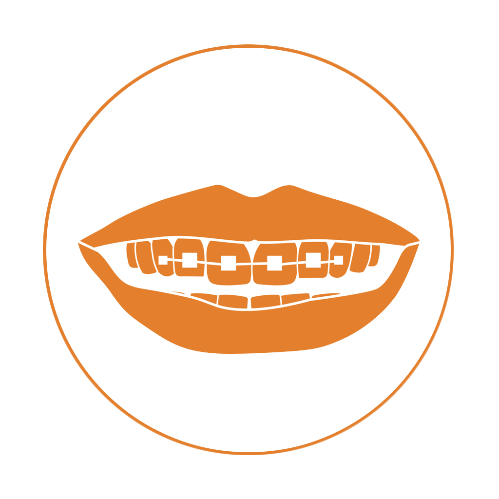 Dental Institute Bolzano apparecchio per i denti